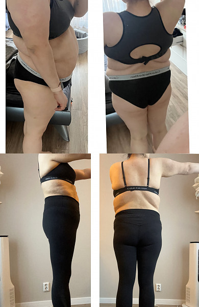 Lipidų rišiklis FORMOLINE L112 EXTR prieš ir po vartojimo